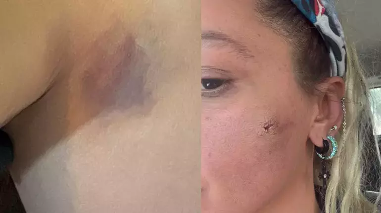 Yıldız Asyalı Darp