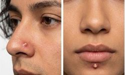 Yeni Trend Yok Artık Dedirtti! Sivilce Görünümlü Piercingler Olay Yarattı