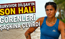 Survivor Dilşah'ın Son Hali Görenleri Şaşkına Çevirdi
