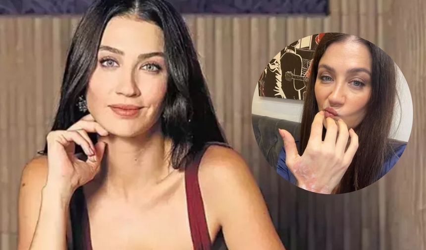 Eşref Rüya Setinde Talihsiz Kaza: Ceren Benderlioğlu’na İlk Müdahale Yapıldı