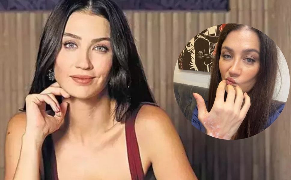 Eşref Rüya Setinde Talihsiz Kaza: Ceren Benderlioğlu’na İlk Müdahale Yapıldı